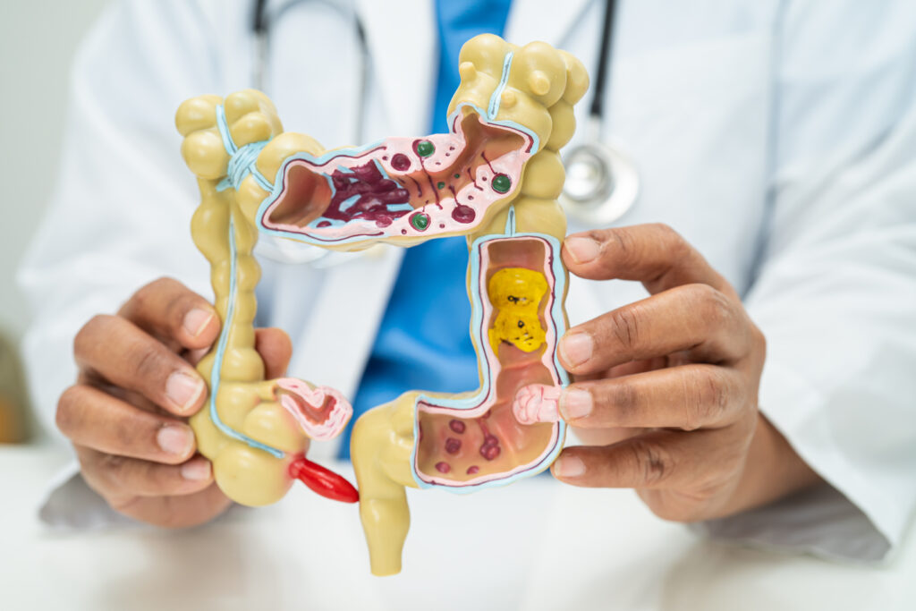 1 Week Colonoscopy diet sheet