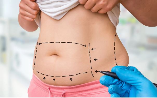 How Much Weight Can You Lose With Liposuction