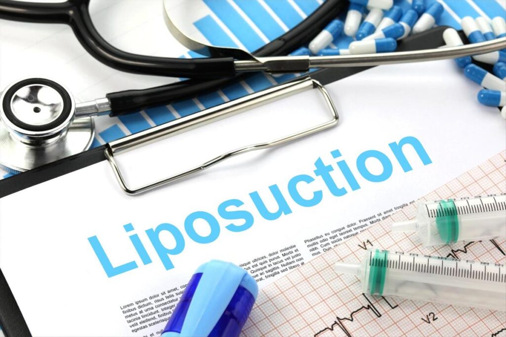 How Much Weight Can You Lose With Liposuction